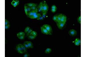 Immunofluorescence (IF) image for anti-Cystatin A (Stefin A) (CSTA) (AA 2-98) antibody (ABIN7148983)