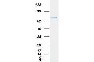 Validation with Western Blot