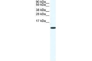 WB Suggested Anti-CCL5 Antibody Titration:  1. (CCL5 抗体  (Middle Region))