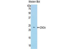 Western Blotting (WB) image for anti-TIMP Metallopeptidase Inhibitor 4 (TIMP4) (AA 42-224) antibody (ABIN1172385) (TIMP4 抗体  (AA 42-224))