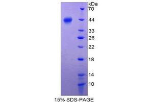 SDS-PAGE (SDS) image for S100 Calcium Binding Protein A2 (S100A2) (AA 2-98) protein (His tag,GST tag) (ABIN1981041) (S100A2 Protein (AA 2-98) (His tag,GST tag))