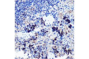 Immunohistochemistry of paraffin-embedded Rat spleen using FCHSD1 Rabbit pAb (ABIN7270317) at dilution of 1:100 (40x lens). (FCHSD1 抗体  (AA 100-400))