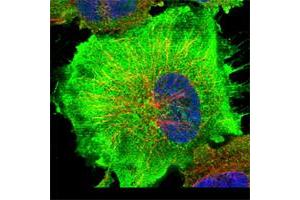 Immunofluorescent staining of human cell line U-251 MG shows positivity in plasma membrane & cytoplasm. (C9 抗体)