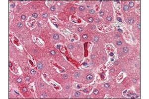 Human Liver (formalin-fixed, paraffin-embedded) stained with FTH1at 4 µg/ml followed by biotinylated anti-goat IgG secondary antibody, alkaline phosphatase-streptavidin and chromogen. (FTH1 抗体  (C-Term, Heavy Chain))