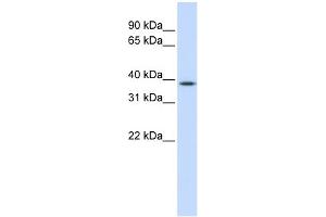 WB Suggested Anti-ELK3 Antibody Titration:  0. (ELK3 抗体  (Middle Region))