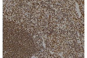 Immunohistochemistry (IHC) image for anti-Protein Phosphatase, Mg2+/Mn2+ Dependent, 1E (PPM1E) (Internal Region) antibody (ABIN6264378)