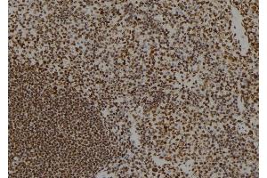ABIN6279693 at 1/100 staining Mouse spleen tissue by IHC-P. (PPM1E 抗体  (Internal Region))