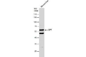 WB Image Mouse tissue extract (50 μg) was separated by 10% SDS-PAGE, and the membrane was blotted with GPT antibody [N1N3] , diluted at 1:500. (ALT 抗体  (N-Term))