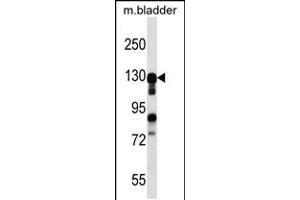 Western blot analysis in mouse bladder tissue lysates (35ug/lane). (MKL2 抗体  (N-Term))