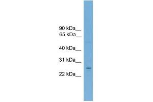 Western Blotting (WB) image for anti-Nuclear Receptor Subfamily 6, Group A, Member 1 (NR6A1) (Middle Region) antibody (ABIN2782300)