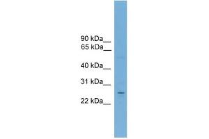 WB Suggested Anti-NR6A1 Antibody Titration:  0. (NR6A1 抗体  (Middle Region))