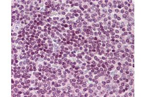 Immunohistochemistry (IHC) image for anti-Cell Division Cycle 20 Homolog (S. Cerevisiae) (CDC20) (N-Term) antibody (ABIN2774602) (CDC20 抗体  (N-Term))