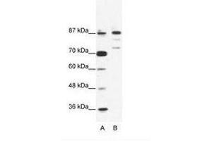 Image no. 1 for anti-BTB and CNC Homology 1, Basic Leucine Zipper Transcription Factor 1 (BACH1) (C-Term) antibody (ABIN203248) (BACH1 抗体  (C-Term))