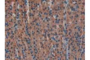 DAB staining on IHC-P; Samples: Rat Stomach Tissue (Lactate Dehydrogenase A 抗体  (AA 1-332))