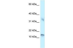 Western Blot showing UTS2D antibody used at a concentration of 1 ug/ml against 721_B Cell Lysate (Urotensin 2B 抗体  (C-Term))