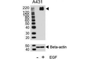 Western blot analysis of lysate from A431 cell line, untreated or treated with EGF (100ng/ml), using phospho-ErbB2 antibody. (ErbB2/Her2 抗体  (pTyr1140))