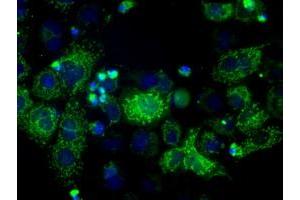 Image no. 1 for anti-Hydroxysteroid (17-Beta) Dehydrogenase 10 (HSD17B10) antibody (ABIN1498724) (HSD17B10 抗体)