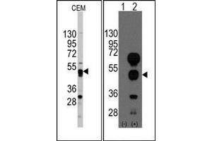 Image no. 1 for anti-GATA Binding Protein 4 (GATA4) (C-Term) antibody (ABIN356870) (GATA4 抗体  (C-Term))