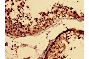 Immunohistochemistry (IHC) image for anti-RNA Binding Motif Protein, Y-Linked Family 1 Member A1 (RBMY1A1) (AA 1-459) antibody (ABIN7168309)