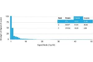Analysis of Protein Array containing more than 19,000 full-length human proteins using Ferritin, Light Chain Mouse Monoclonal Antibody (FTL/1386) Z- and S- Score: The Z-score represents the strength of a signal that a monoclonal antibody (MAb) (in combination with a fluorescently-tagged anti-IgG secondary antibody) produces when binding to a particular protein on the HuProtTM array. (FTL 抗体  (AA 38-165))