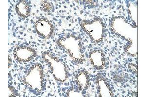Image no. 1 for anti-Ubiquitin-Conjugating Enzyme E2, J1, U (UBE2J1) (N-Term) antibody (ABIN203528) (UBE2J1 抗体  (N-Term))