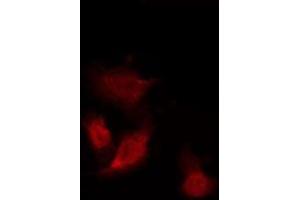 ABIN6275960 staining Hela by IF/ICC. (GPR153 抗体  (Internal Region))