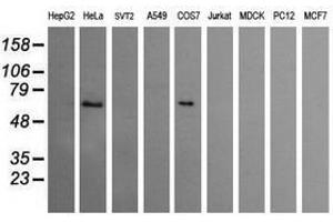Image no. 3 for anti-Chaperonin Containing TCP1, Subunit 8 (Theta)-Like 2 (CCT8L2) antibody (ABIN1497482) (CCT8L2 抗体)
