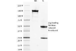 SDS-PAGE (SDS) image for anti-Spectrin alpha 1, Erythrocytic (SPTA1) (AA 356-475) antibody (ABIN6940644)