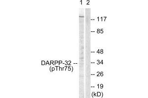 Western Blotting (WB) image for anti-Protein Phosphatase 1, Regulatory (Inhibitor) Subunit 1B (PPP1R1B) (pThr75) antibody (ABIN1847208) (DARPP32 抗体  (pThr75))