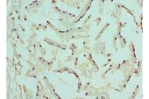 Immunohistochemistry of paraffin-embedded human prostate tissue using ABIN7148788 at dilution of 1:100 (AFT1 抗体  (AA 1-210))