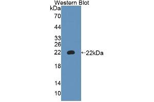 Western blot analysis of recombinant Mouse a4GALT. (A4GALT 抗体  (AA 94-270))