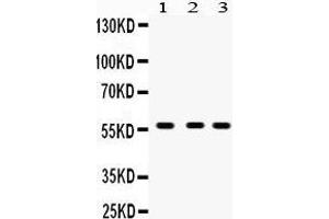 Western Blotting (WB) image for anti-Cytochrome P450, Family 27, Subfamily B, Polypeptide 1 (CYP27B1) (AA 475-508), (C-Term) antibody (ABIN3042787) (CYP27B1 抗体  (C-Term))