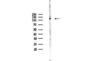 anti-Integrin alpha D (ITGAD) (Internal Region) antibody