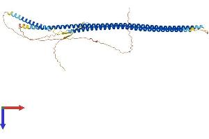 Keratin 26 Protein (KRT26) (AA 1-468) (His tag)