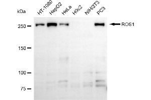 Western blotting analysis using ROS1 antibody (ABIN7797813).