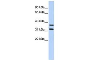 Image no. 1 for anti-Zinc Finger Protein 254 (ZNF254) (AA 151-200) antibody (ABIN6744476) (ZNF254 抗体  (AA 151-200))