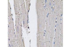 Immunohistochemistry of paraffin-embedded Mouse heart using GLUT3 Polyclonal Antibody (SLC2A3 抗体)
