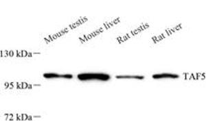 Western Blotting (WB) image for anti-TAF5 RNA Polymerase II, TATA Box Binding Protein (TBP)-Associated Factor, 100kDa (TAF5) antibody (ABIN7075828)