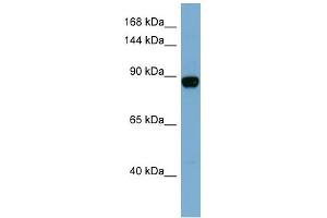 WB Suggested Anti-CASD1 Antibody Titration:  0. (CASD1 抗体  (N-Term))