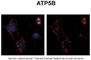 Immunohistochemistry (IHC) image for anti-ATP Synthase, H+ Transporting, Mitochondrial F1 Complex, beta Polypeptide (ATP5B) (C-Term) antibody (ABIN2783269)