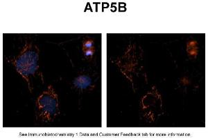 Sample Type: NT2 cellsRed: AntibodyBlue: DAPIPrimary Dilution: 1ug/50ul antibodySecondary Antibody: Alexa goat anti-rabbit 594Image Submitted by: Yuzhi Chen, University of Arkansas for Medical Sciences (ATP5B 抗体  (C-Term))