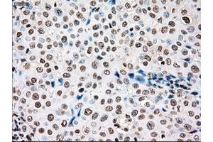 Image no. 1 for anti-TYRO3 Protein Tyrosine Kinase (TYRO3) antibody (ABIN1501605) (TYRO3 抗体)