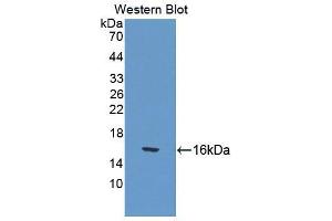 Western blot analysis of the recombinant protein. (CUBN 抗体  (AA 98-207))