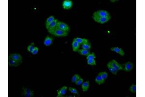 Immunofluorescence staining of HepG2 cells with ABIN7165300 at 1:133, counter-stained with DAPI. (DOK7 抗体  (AA 416-504))