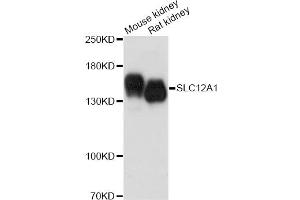 Western blot analysis of extracts of various cell lines, using SLC12A1 antibody. (SLC12A1 抗体)
