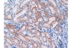 DAB staining on IHC-P; Samples: Mouse Kidney Tissue (CTLA4 抗体  (AA 45-185))