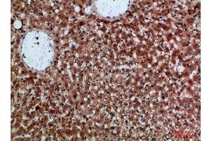 Immunohistochemical analysis of paraffin-embedded human-liver, antibody was diluted at 1:200 (CDNF 抗体  (AA 31-80))