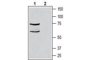 Western blot analysis of human THP-1 monocytic leukemia cell line lysate: - 1. (CALCRL 抗体  (C-Term, Intracellular))