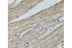 Immunohistochemistry of paraffin-embedded Rat heart using EIF4A2 Polyclonal Antibody at dilution of 1:100 (40x lens). (EIF4A2 抗体)