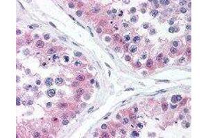 Immunohistochemistry (IHC) image for anti-Mitogen-Activated Protein Kinase 1 (MAPK1) antibody (ABIN2666104) (ERK2 抗体)